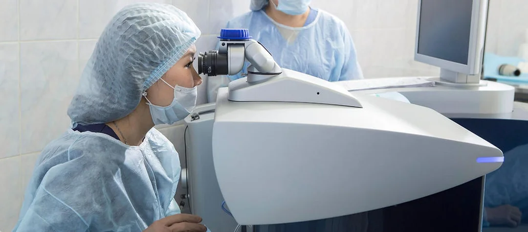 Cách chữa cận thị bằng phẫu thuật khúc xạ cách chữa cận thị bằng phẫu thuật khúc xạ cần đánh giá giác mạc kỹ