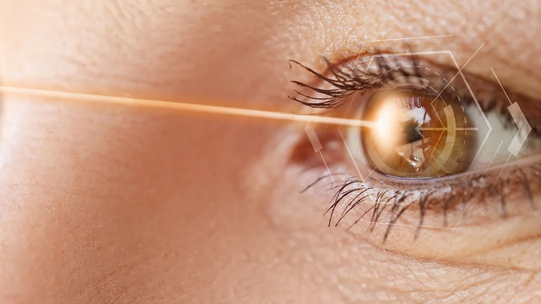 Chi phí bắn tia laser trị cận thị bao nhiêu tiền theo phương pháp