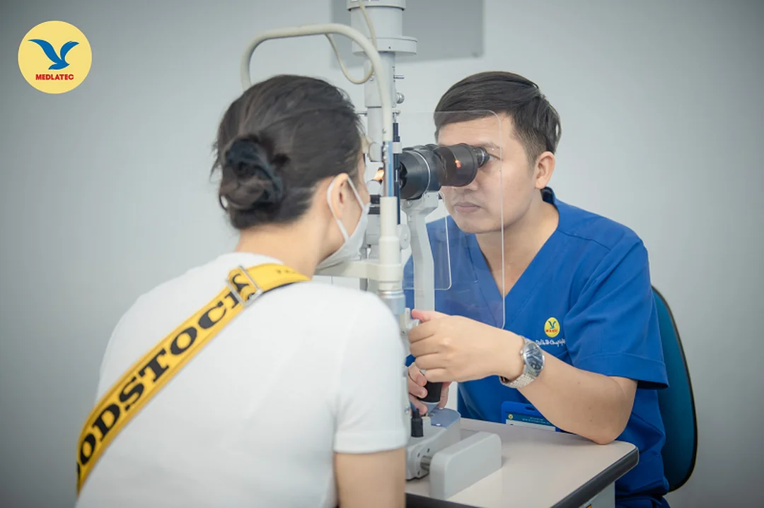 dấu hiệu cận thị - hình minh họa 3 dấu hiệu cận thị - hình minh họa 3
