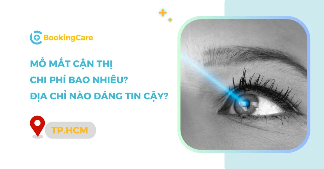 mổ cận thị bao nhiêu tiền tại bệnh viện mắt