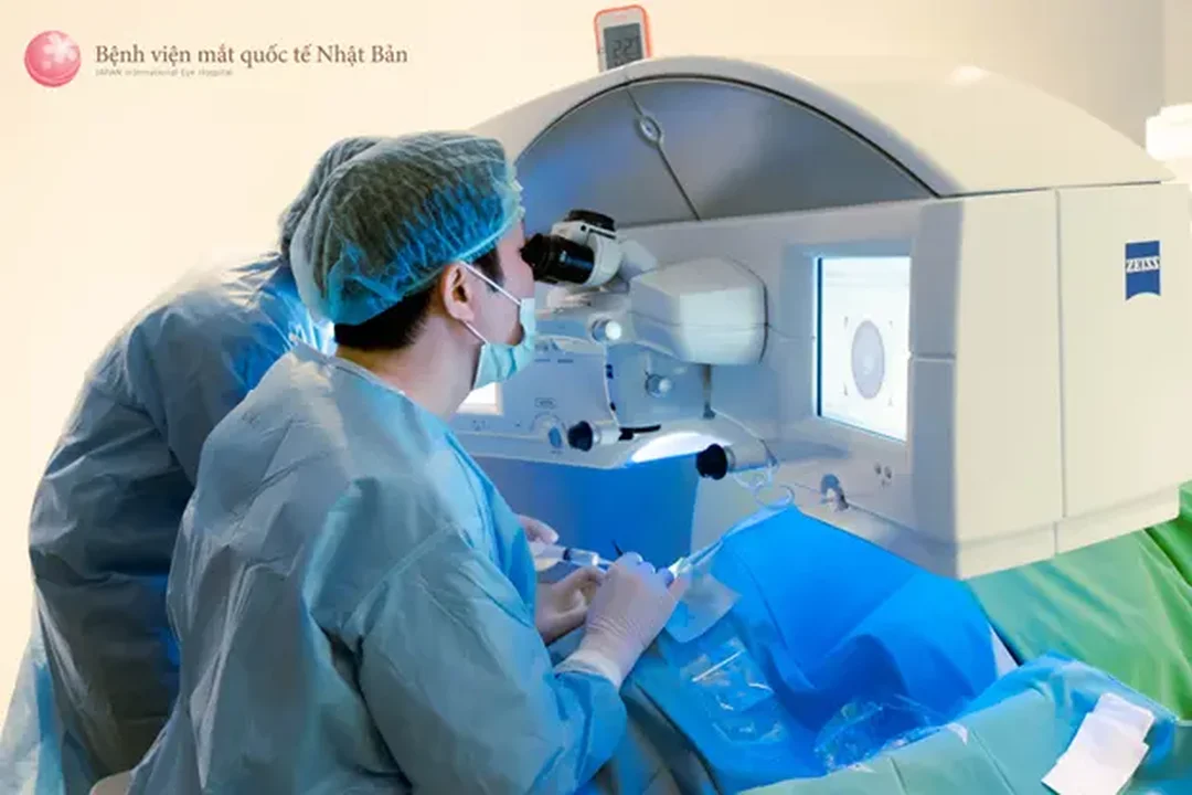 Câu hỏi thường gặp về mổ mắt chữa cận thị mổ mắt chữa cận thị và những câu hỏi người bệnh thường gặp