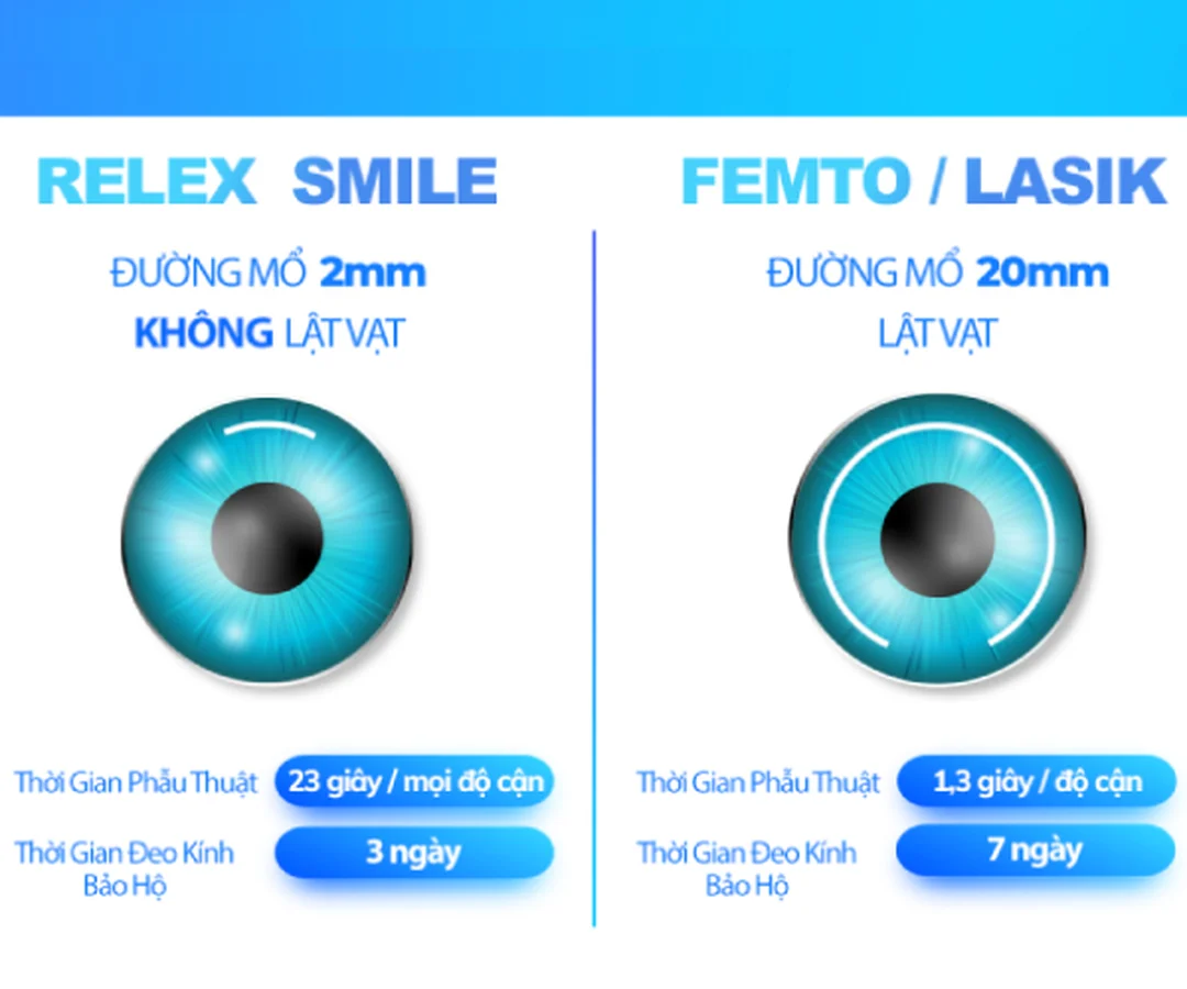 Review các phương pháp mổ cận LASIK Femto SMILE