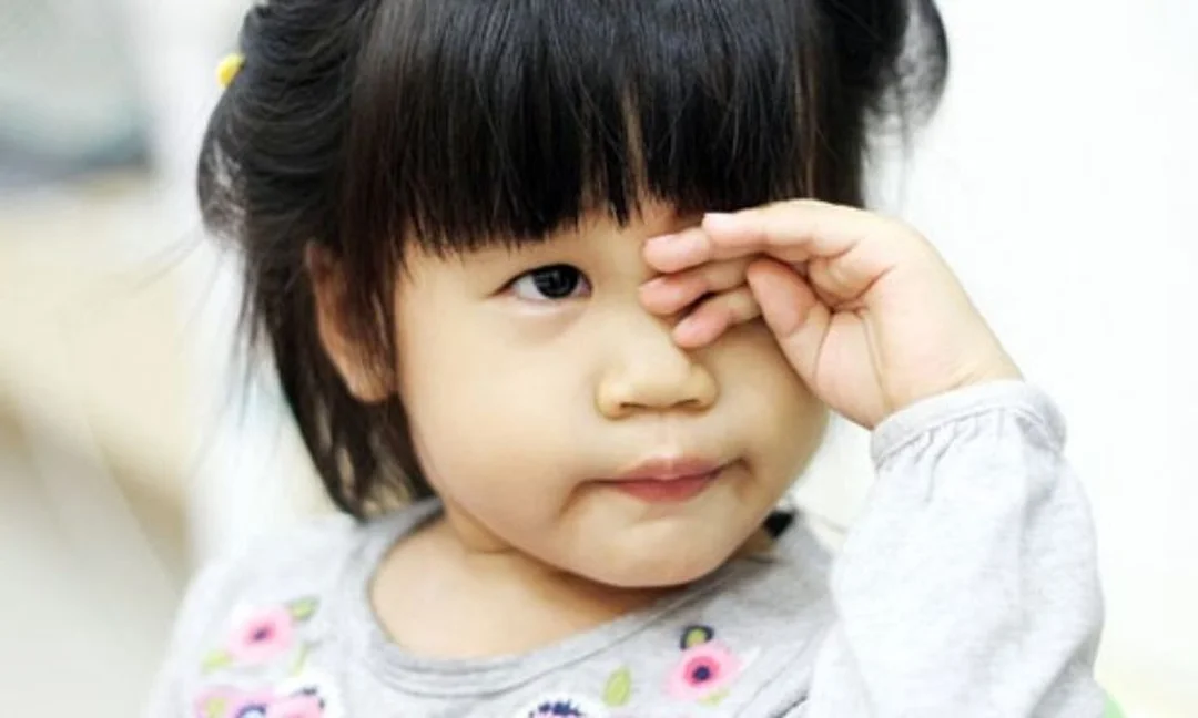 Trẻ bị cận thị có thể dụi mắt và nheo mắt thường xuyên triệu chứng cận thị ở trẻ em thường là dụi mắt và nheo mắt