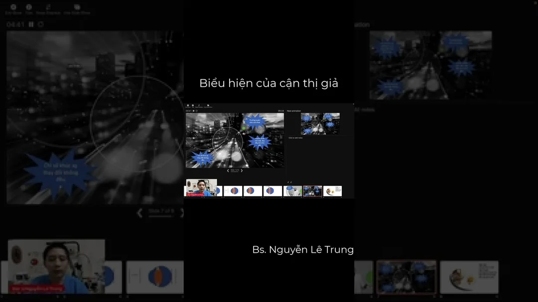 Video triệu chứng cận thị giả