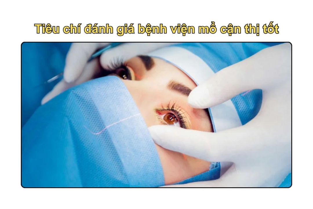Bác sĩ tư vấn tiêu chí chọn bệnh viện mổ cận thị bác sĩ tư vấn mổ cận thị ở đâu tốt nhất tphcm