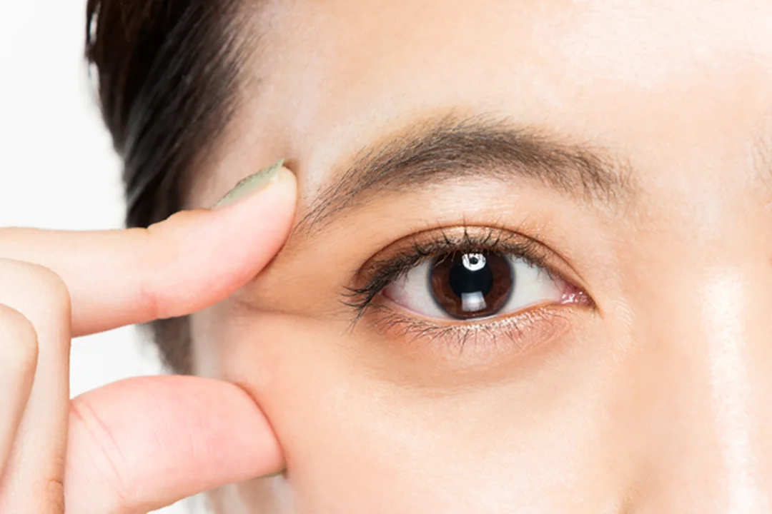 Khám mắt chuyên khoa khi nhìn xa mờ kéo dài bấm huyệt chữa cận thị không thay thế khám mắt chuyên khoa