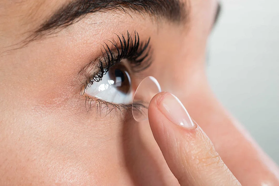 Quy trình khám trước khi bắn laser mắt cận thị bắn laser mắt cận thị cần quy trình khám chuyên sâu