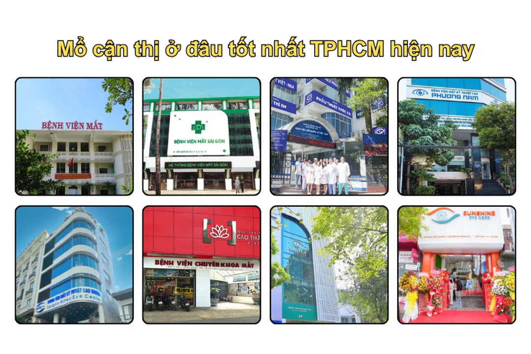 Tiêu chí chọn nơi mổ cận thị ở TPHCM bảng tiêu chí chọn mổ cận thị ở đâu tốt nhất tphcm