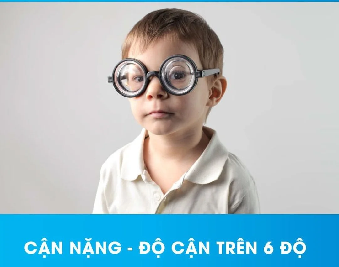bị cận thị nhìn xa mờ cần đo khúc xạ