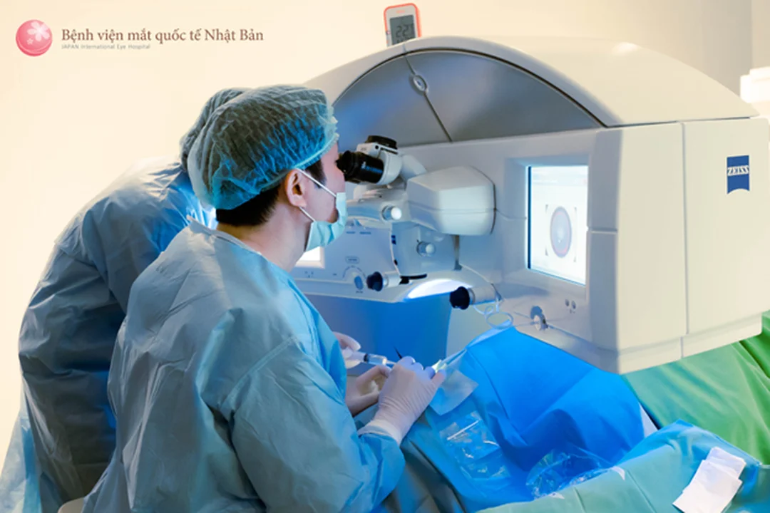 các khoản cần dự trù trong chi phí mổ cận thị
