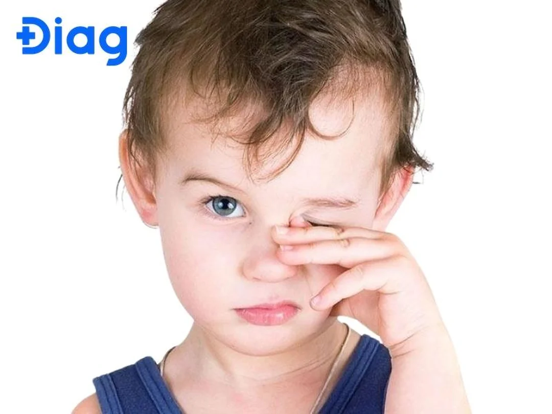 Đo khúc xạ để đánh giá cận thị bẩm sinh cận thị bẩm sinh có chữa được không cần đo khúc xạ và theo dõi độ cận