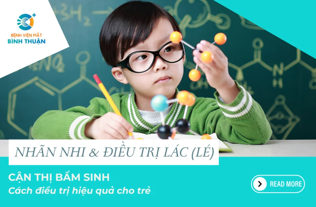 Câu hỏi thường gặp về cận thị bẩm sinh cận thị bẩm sinh có chữa được không và câu hỏi thường gặp của phụ huynh