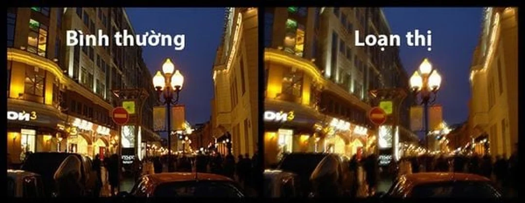 cận thị nhìn như thế nào do hình ảnh hội tụ trước võng mạc