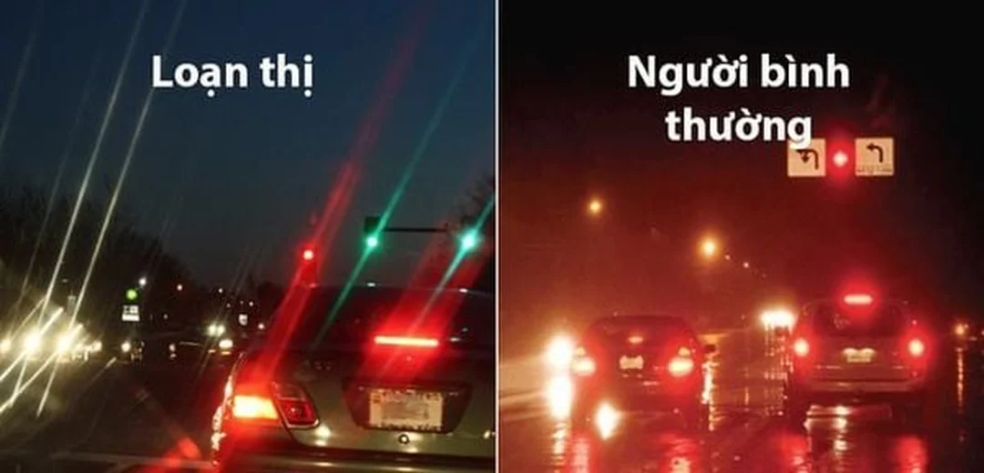 cận thị nhìn như thế nào khi nhìn xa bị mờ nhòe