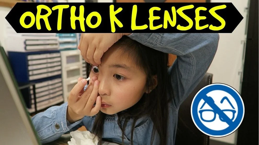 Tư vấn trước khi chữa cận thị bằng kính đeo ban đêm chữa cận thị bằng kính đeo ban đêm cần được bác sĩ giải đáp trước khi dùng