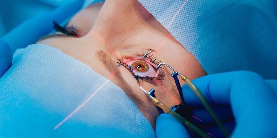 Bác sĩ kiểm tra mắt trước khi chữa cận thị bằng laser chữa cận thị bằng laser với bác sĩ đang kiểm tra mắt trước phẫu thuật