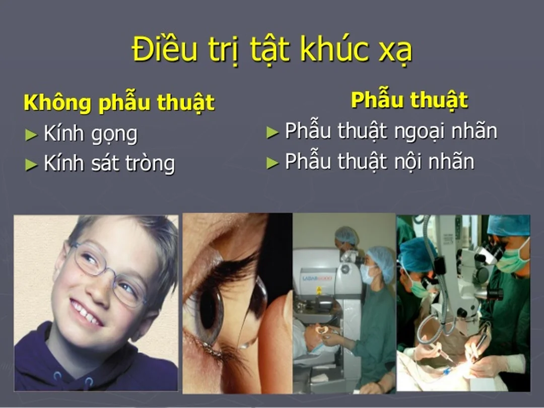 Kính và đo khúc xạ trong điều trị cận thị điều trị cận thị bằng kính và phương pháp kiểm soát tiến triển