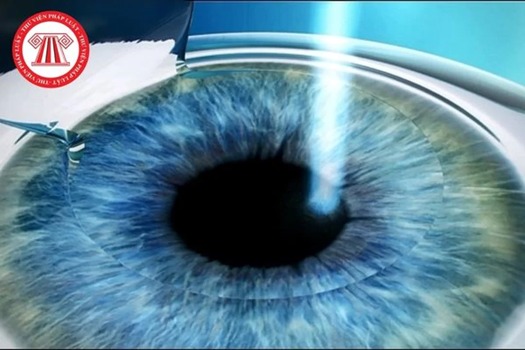 Phòng phẫu thuật điều trị cận thị bằng laser điều trị cận thị bằng laser trong phòng phẫu thuật mắt