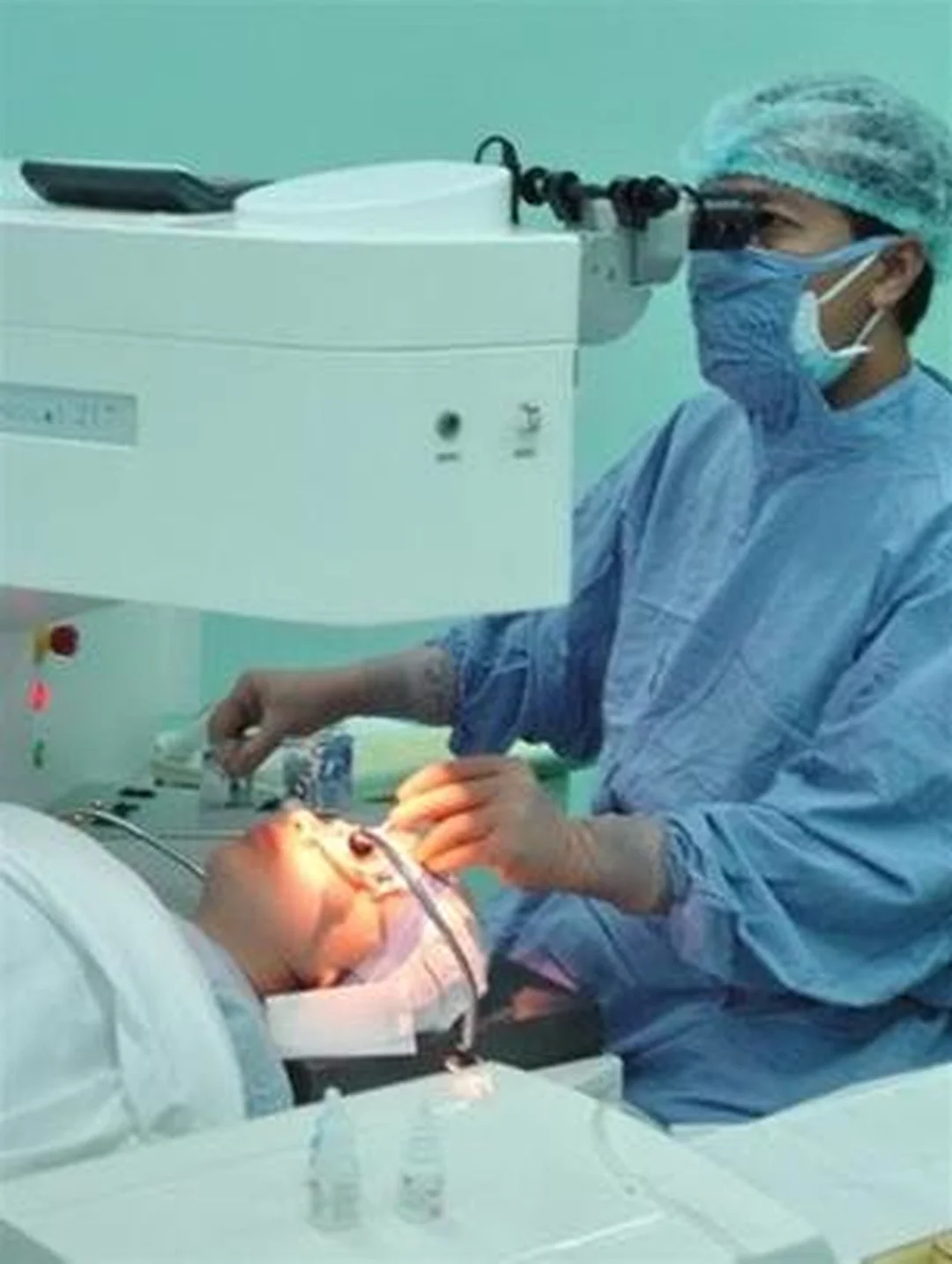 phẫu thuật cận thị lasik có thể gây khô mắt và lóa sáng sau mổ