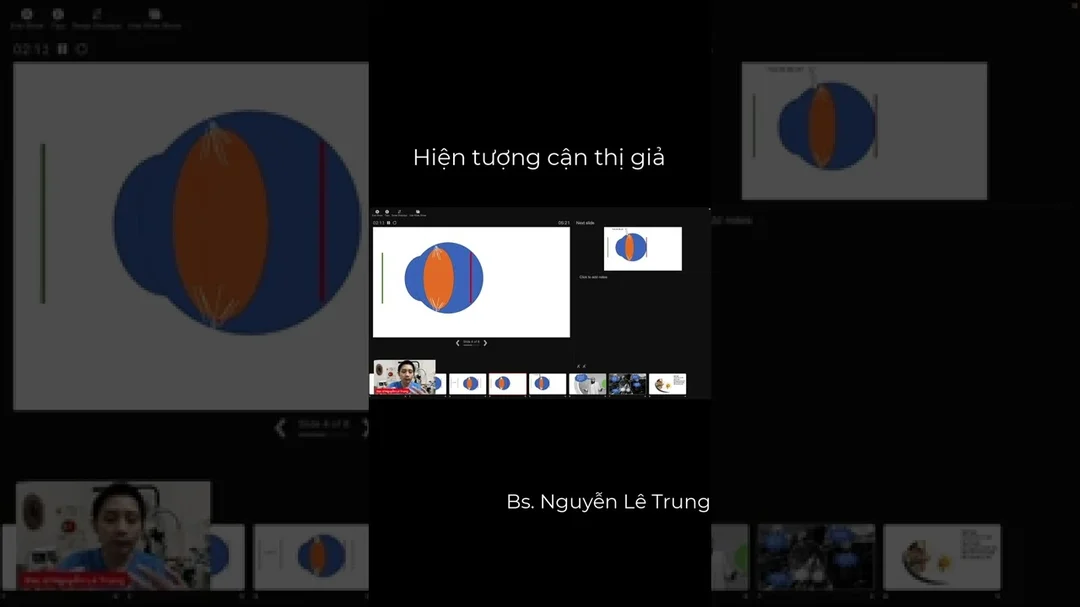 Video giải thích cận thị giả là gì