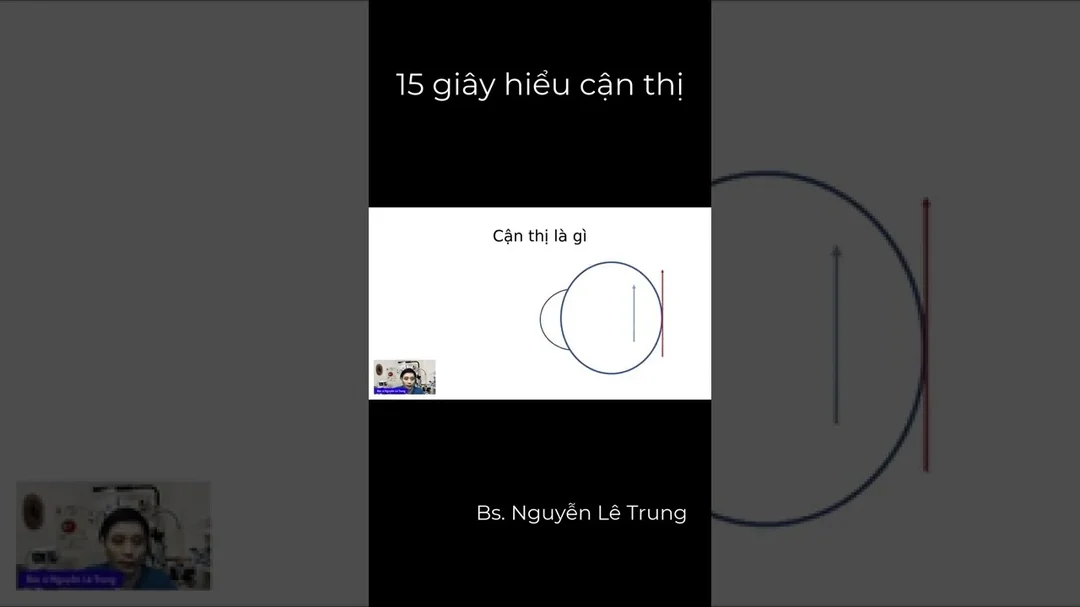 Video giải thích ngắn về cận thị