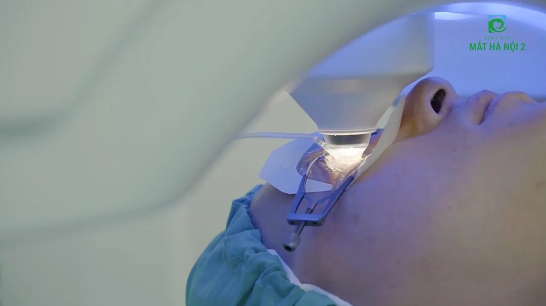 Video giải thích phẫu thuật Femto Lasik trong mổ cận thị