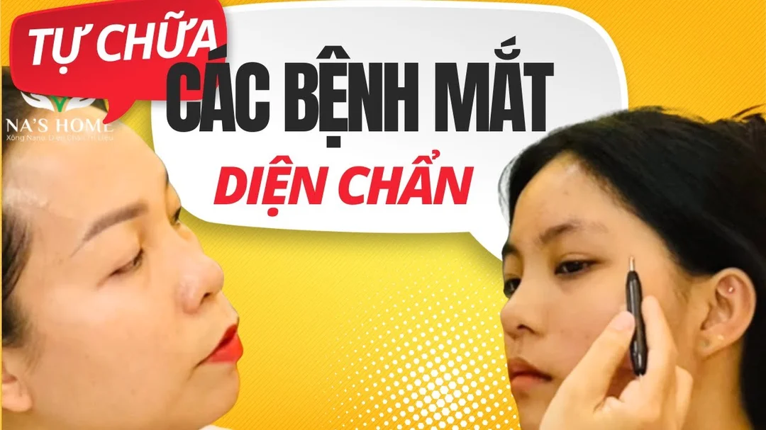 Video hướng dẫn diện chẩn liên quan đến cận thị và nhược thị