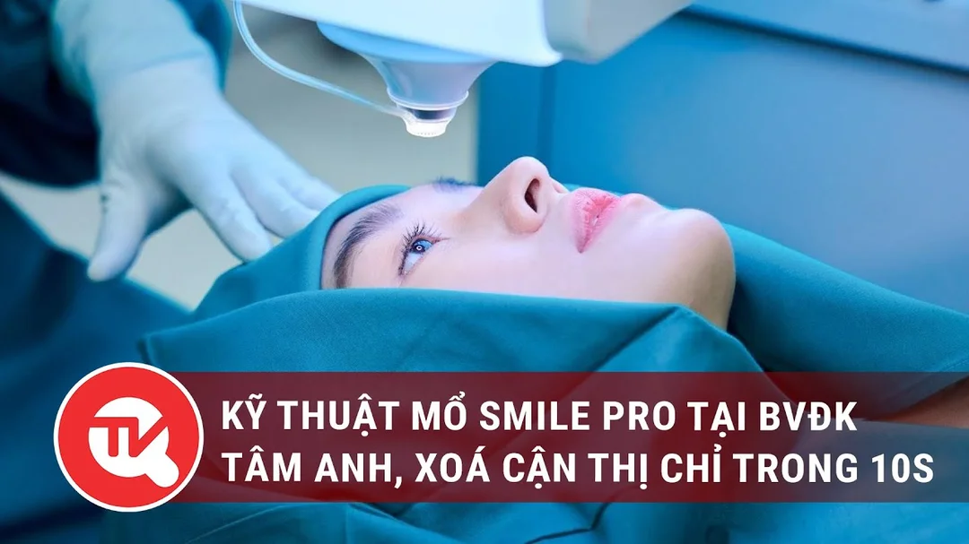 Video kỹ thuật mổ cận SMILE Pro cho người tìm hiểu phẫu thuật cận thị