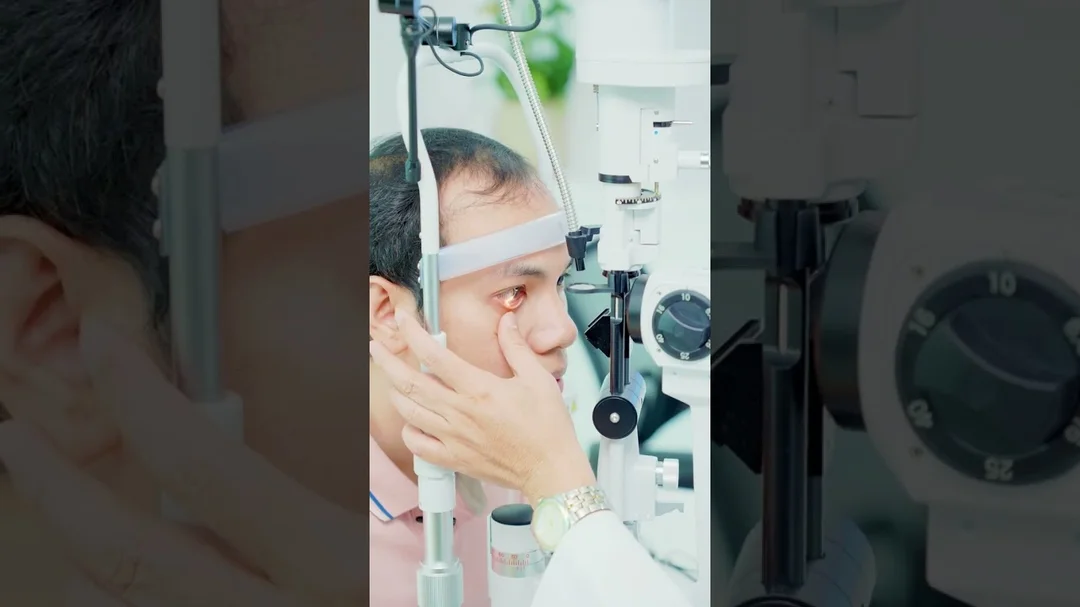 video quy trình mổ cận thị ReLEx SMILE tại TPHCM
